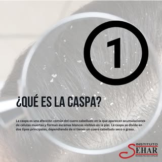 ¿CÓMO ELIMINO LA CASPA?
CAUSAS, SÍNTOMAS Y TRATAMIENTOS
No te pierdas el final!

La caspa es una afe