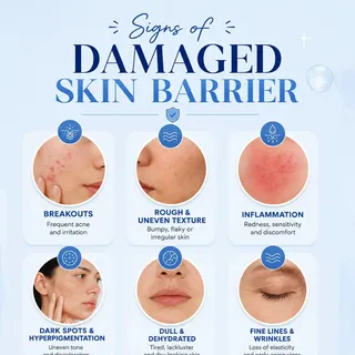 Your skin barrier protects your skin every day. If you're noticing breakouts, dryness, redness, or s