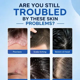 Your skin and scalp are trying to tell you something—don't ignore the signs. From psoriasis and acne