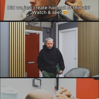 Latest video from @truhair_uk 
We keep rolling them out 😮‍💨#hairloss #hairlosshelp #hairreplacemen