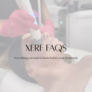 Your XERF questions, answered. ✨ Swipe for our most frequently asked FAQs and everything you need to