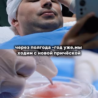 делайте хорошую пересадку в проверенном месте @ahdclinic ! 
не забудьте подписаться здесь все о совр