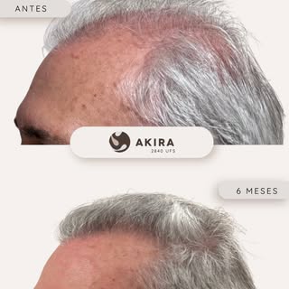 ✨ Cuando el cuidado marca la diferencia, los resultados hablan solos ✨

Cada paciente llega con una 