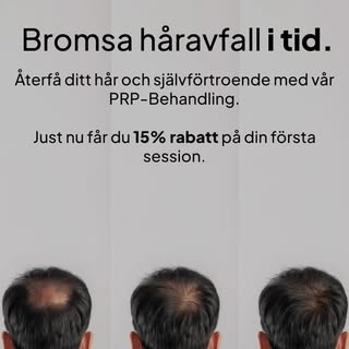 15% Rabatt på PRP-Behandling till 30/9-24💉