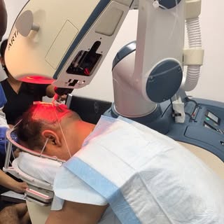 #robotic #hairrestoration with the #artas system in #beverlyhills No linear scar. Quick recovery. Go