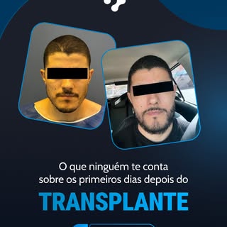 O que ninguém te conta sobre os primeiros dias depois do transplante.

A recuperação é mais simples 
