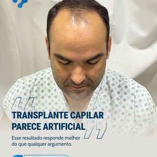 "Transplante capilar parece artificial."

Esse resultado responde melhor do que qualquer argumento.
