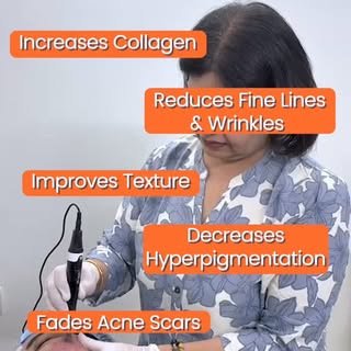 ✨ Acne marks, stubborn pigmentation, and dark spots taking forever to fade? These dermatologist-reco