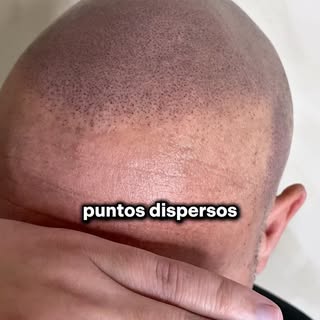 Así se ve una línea frontal recién terminada.

El enrojecimiento es parte del proceso, en unos días 
