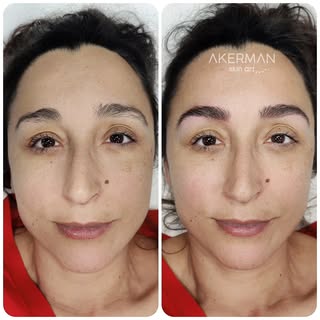 Cejas realistas, naturales, trabajadas con micropigmentación. Pelo a pelo, efecto sombreado donde es