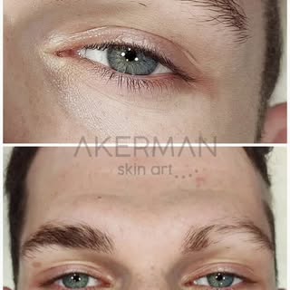 Restaurando una ceja masculina, consiguiendo el mismo color de su pelo, dando el efecto deseado con 