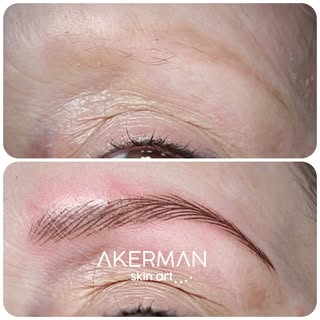 Micropigmentacion de cejas donde no había pelo. Antes de hacer este trabajo realicé 2 sesiones de lá