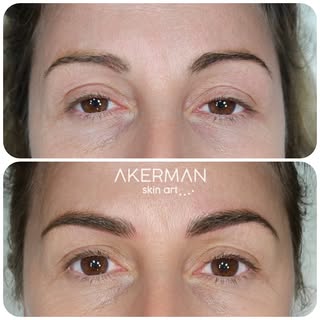 Micropigmentacion de cejas, naturales, definidas, perfectamente adpatadas al rostro de cada persona.