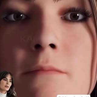 Para quem é indicado o Lip Lift?
Nem todo lábio precisa de preenchimento. Às vezes, o segredo está n
