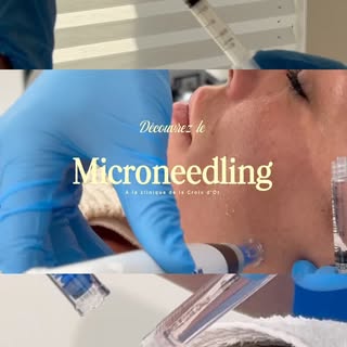 ✨ Microneedling avec Dermapen : révéler la qualité de votre peau, en douceur
À la Clinique de la Cro