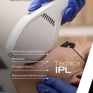 Cada piel necesita un abordaje distinto.
En ALFA Dermatología y Tricología utilizamos tecnologías co