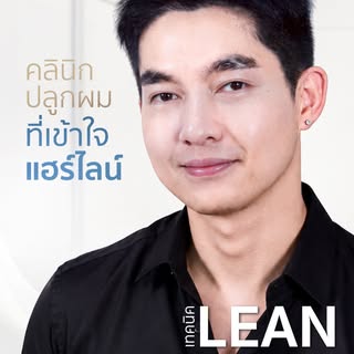 ปลูกผม LEAN Non-Shaven ไม่แถ ไม่โกน​
เคสนี้ต้องการปรับกรอบหน้าให้สมดุล​
จากปัญหาแนวผมเว้าสูงจนขาดควา