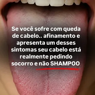 Você pode estar tentando tratar a queda de cabelo com shampoo, tônico e vitaminas... mas ignorando o