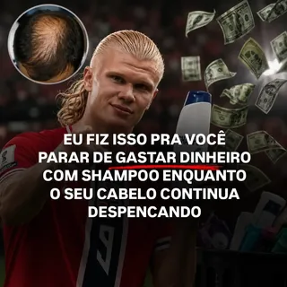 🚨 Você pode gastar uma fortuna com shampoo e ainda continuar perdendo cabelo.
O shampoo tem sua fun
