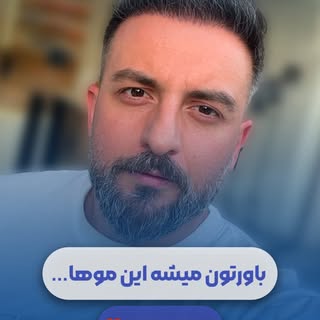 ⁨	✨ فقط ۶ ماه از کاشت مو گذشته✨

نتیجه‌ای که می‌بینید حاصل طراحی اصولی
اجرای دقیق و رعایت مراقبت‌های