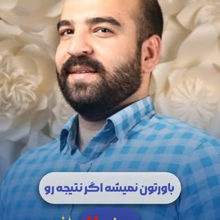 نتیجه کاشت مو بعد از ۵ سال‼️⏳
ببینید که چطور گذر زمان،کیفیت این کاشت رو تایید کرده😌
این یعتی کاشت م