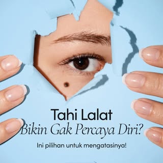 Bagi sebagian orang, tahi lalat bisa menjadi ciri khas. Namun bagi yang lain, keberadaannya justru m