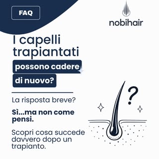 ❌ “I capelli trapiantati cadono... quindi il trapianto non ha funzionato.”

È uno dei miti più diffu