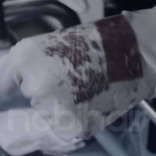 Hai mai visto da vicino i follicoli che rendono possibile un trapianto di capelli naturale? 🔬

È da