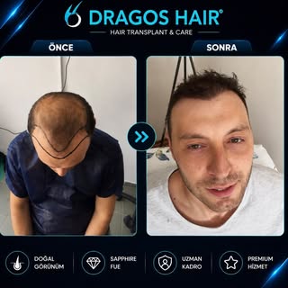 Saç dökülmesini ertelemeyin.

Bugün yapacağınız doğru planlama, gelecekteki görünümünüzü belirler.

