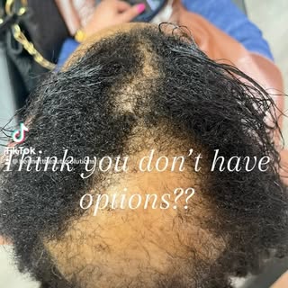 Come see us, we got you girl!! www.bennettbeautysolutions.com #nashville #hairloss #alopecia #nashvi