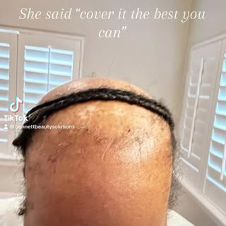 Issa SEW IN 😘 bennettbeautysolutions.com #hairloss #alopecia #nashville #nashvillehair #extensions 