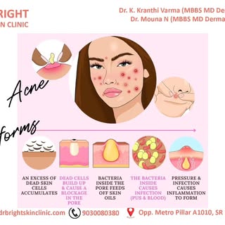 #brightskinclinicsrnagar  #skinspecialist  #dermatologist  #skin  #skincaretips  #skincare  #chemica