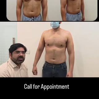 🔥 “2 Days After Gynecomastia Surgery – What Now?” | Real Patient. Real Recovery.

In this reel, Dr.