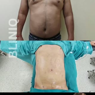 ✨ Instant Transformation Begins! ✨

The "after" images you're seeing were taken immediately after li