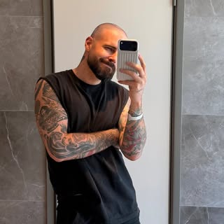 Bon, le voici enfin, mon récap de ma greffe de cheveux avec @elithair.global !! ✨👌🏼

J’ai reçu éno