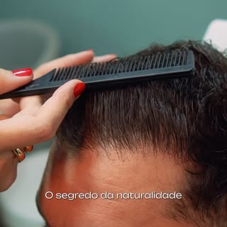 Depoimento do nosso paciente que realizou o Transplante Capilar com a @drafernandachaves ✨

Nada mel