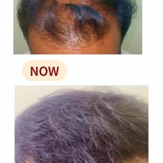 From low confidence to a brand new beginning ✨
After visiting multiple places, he finally trusted De
