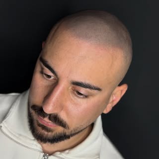 Tricopigmentazione: Soluzione Rapida per la
Perdita di Capelli!
La tricopigmentazione ripristina il 