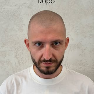 DOPO.

Non sembra tricopigmentazione.

Sembra semplicemente il tuo look.

Linea frontale studiata, s