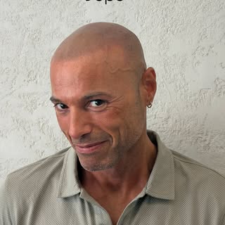 C’è un dettaglio che mi piace più del risultato.

Quel sorriso.

Perché alla fine la tricopigmentazi