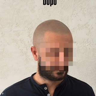 L’obiettivo non è creare l’illusione di avere più capelli.

L’obiettivo è ricreare un effetto rasato