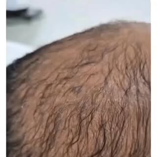 Healthy hair starts with healthy scalp care ✨
At Cayman Trichology Clinic, we specialize in advanced