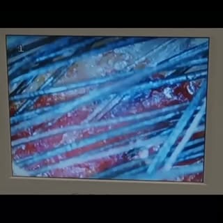 Your scalp is trying to tell you something. itching, tenderness, redness, oe flaking could be sings 