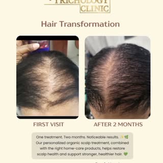 "Healthy hair begins at the root.🌿✨️
One personalized treatment over two months can deliver noticea