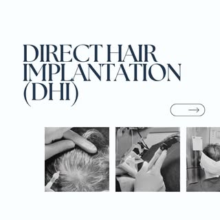 Swipe to learn about Direct Hair Implantation (DHI), available at @agiosporfiriosmedical & @revivacy