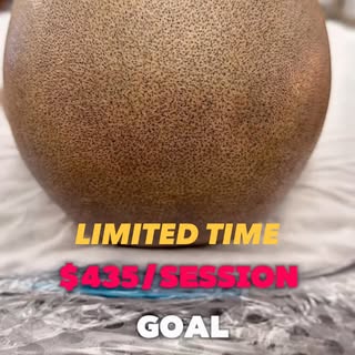 ‼️DO NOT MISS THIS LIMITED TIME OPPORTUNITY TO SAVE‼️

#scalpmicropigmentation #smp #newengland #hai