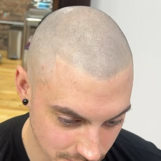 A day in the life @jonathangerow 🤩🫶🏻 #smp #scalpmicropigmentationtraining #hairloss #hairlosssolu
