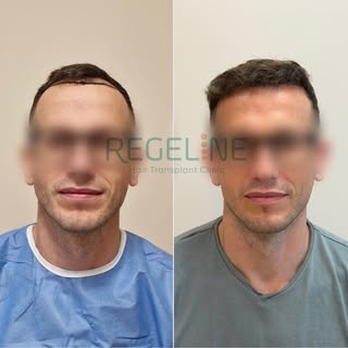 Incredible progress after only half a year – amazing results!
