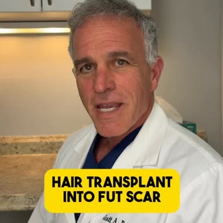 Let’s talk about how to conceal a FUT scar!
#hairloss #hairtransplant