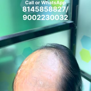 ✨ Confidence begins with the right hair. ✨

Thin hair, hair loss, or low volume shouldn’t stop you f